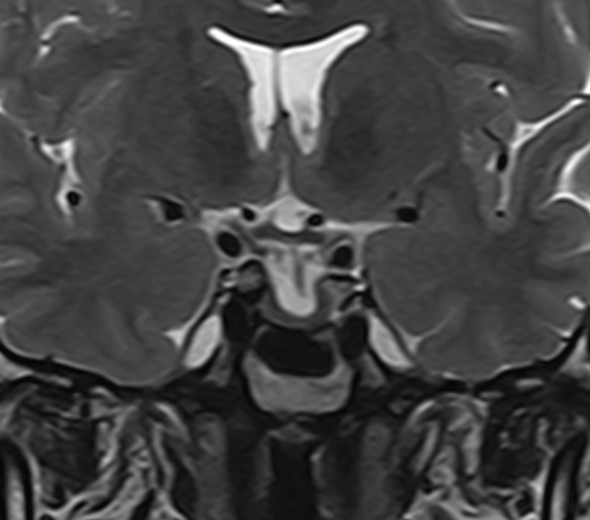 1524110335593938.jpg 1524110335593938.jpg