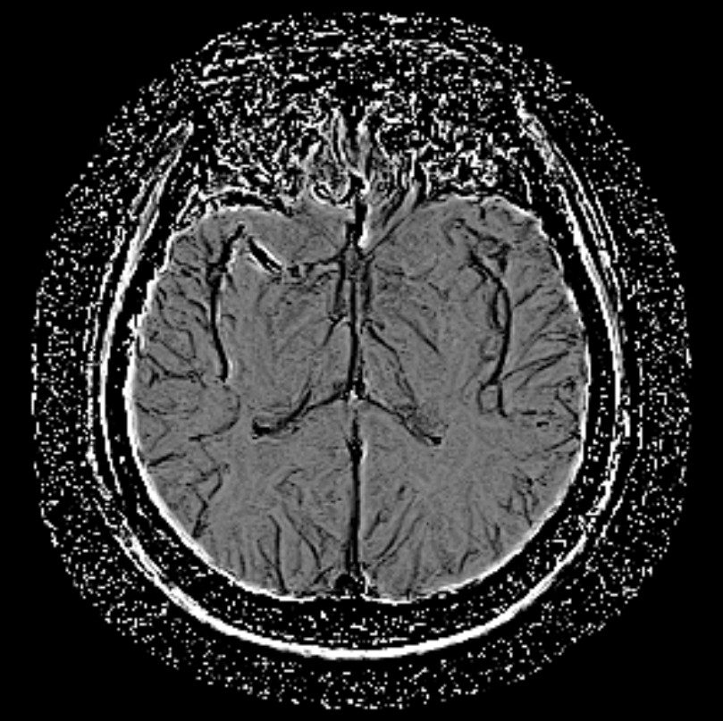 1524110461277440.jpg 1524110461277440.jpg