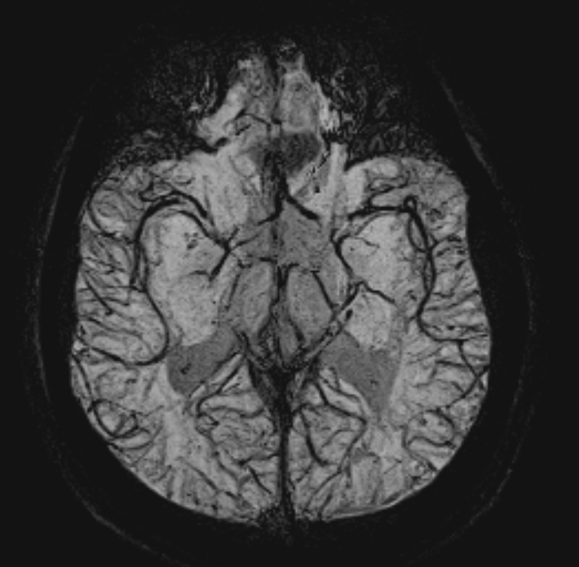 1524110462280552.png 1524110462280552.png